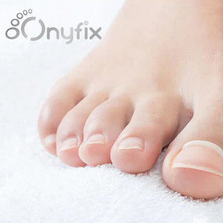 Close-up of healthy-looking toenails with the Onyfix logo in the background, representing the Onyfix Certification Course